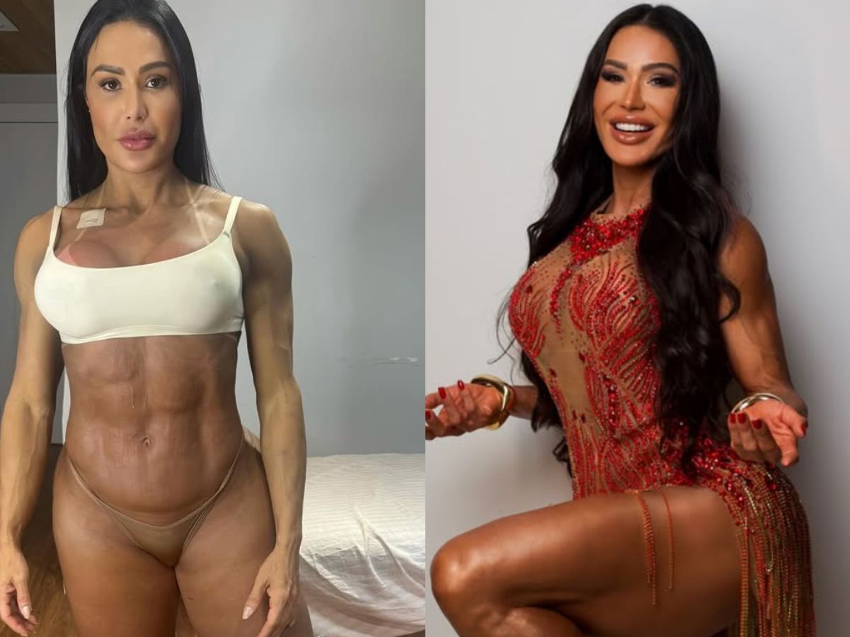 Gracyanne Barbosa esclarece ganho de 20 kg após cirurgia: “Não foi gordura”