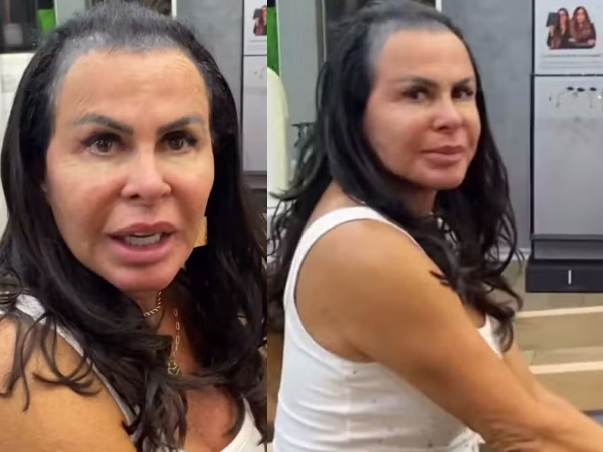 Gretchen se pronuncia sobre queda de cabelo e fala sobre amor-próprio