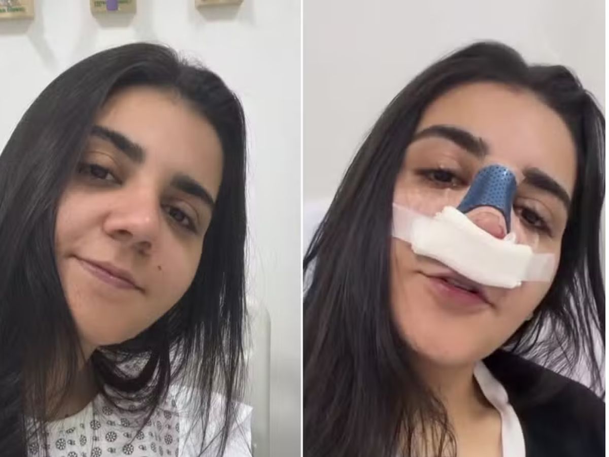 Após cirurgia, Yasmin Santos mostra resultado e celebra nova fase: “Fiz por mim”