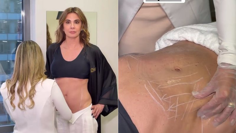 Aos 56 anos, Luciana Gimenez inicia tratamento estético para reforçar definição do abdômen